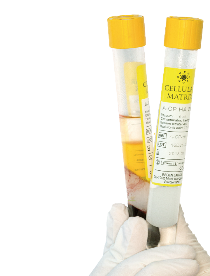CM Tube-1