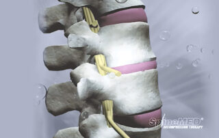 SpineMED CI Breitenbacher Final Web