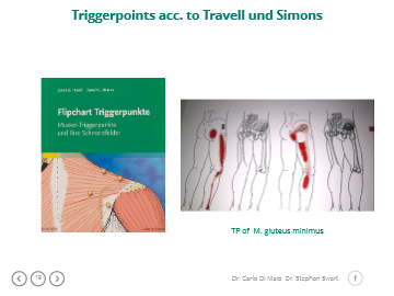 Trigger Skizze